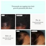 Nutrafol Women's Hair Growth Supplements, Ages 18-44, Clinically Proven for Visibly Thicker and Stronger Hair, Dermatologist Recommended - 1 Month Supply - Image 3